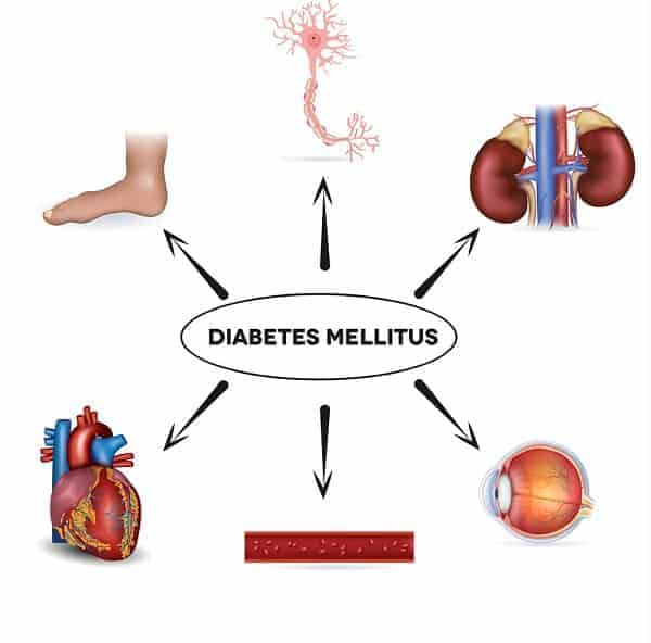 Diabetes-Melinus.jpg Diabetes mellitus