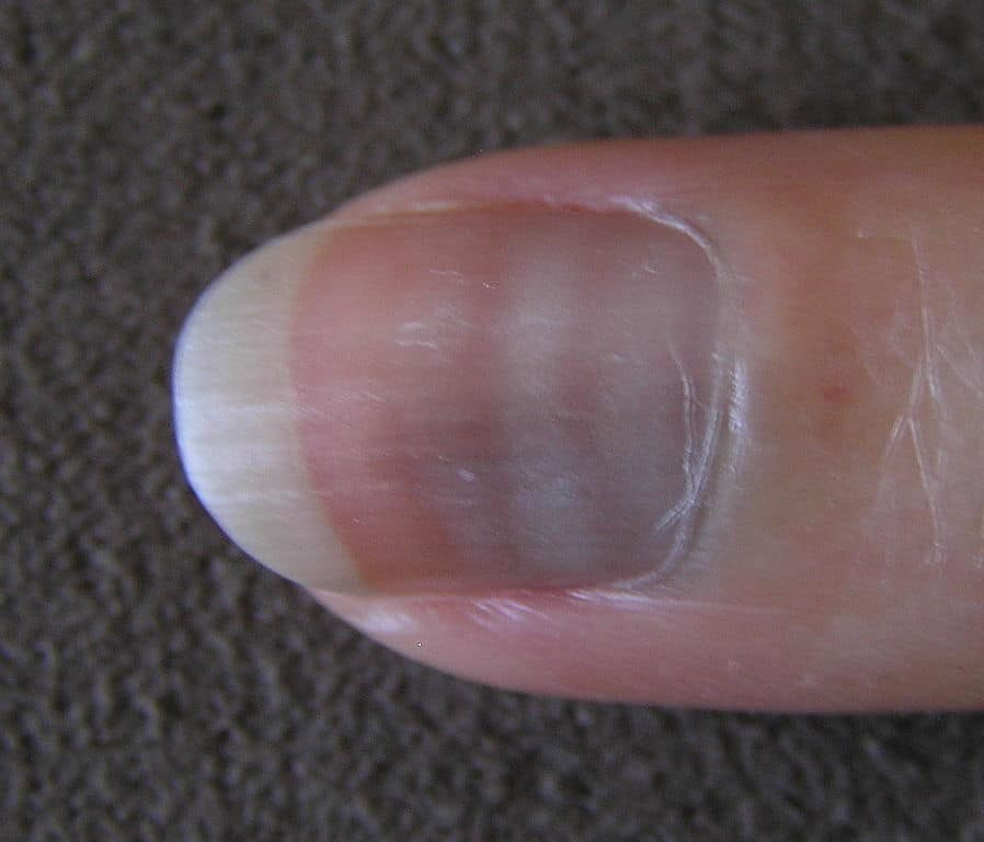 Mees Linien