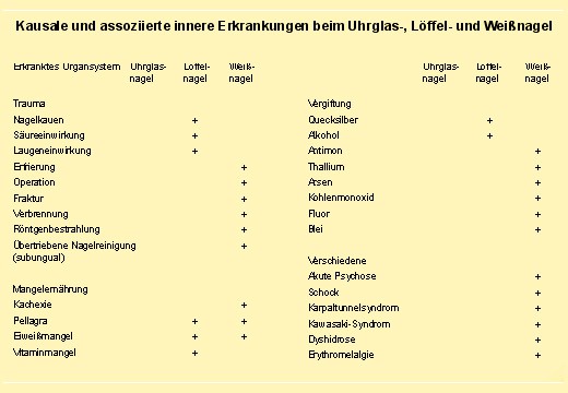 Weißnagel Erkrankungen Teil 2 Nagelveränderung Weißnägel was bedeutet das? 4
