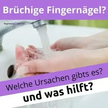 Bruchige Fingernagel Was Hilft Wirklich Dagegen Nageldesign Zentrale