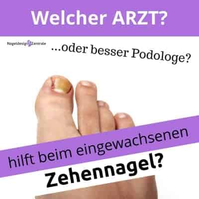 Eingewachsener Zehennagel? Welcher Arzt?