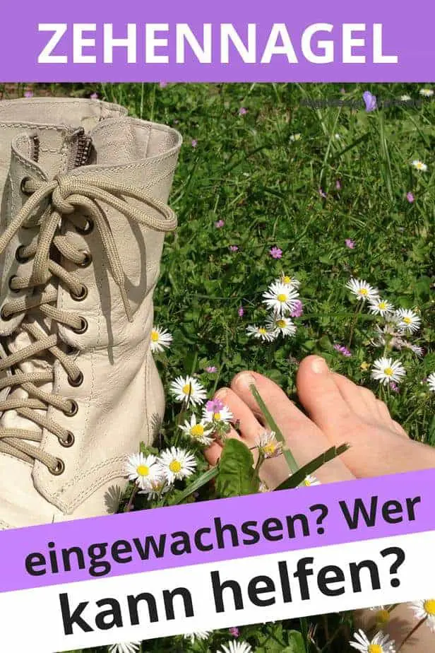 #Fußnagel #eingewachsen #Rollnagel #Nagelspange #Podologe